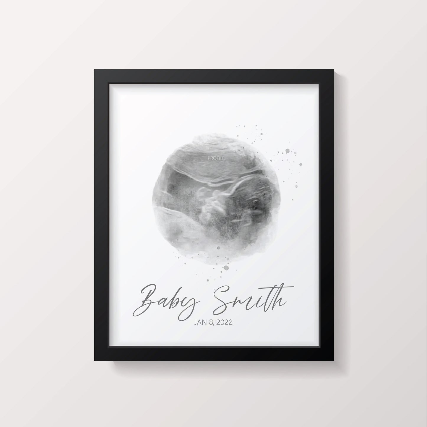 Miscarriage Ultra Sound Keepsake Stillborn Baby Memorial | Digital Print